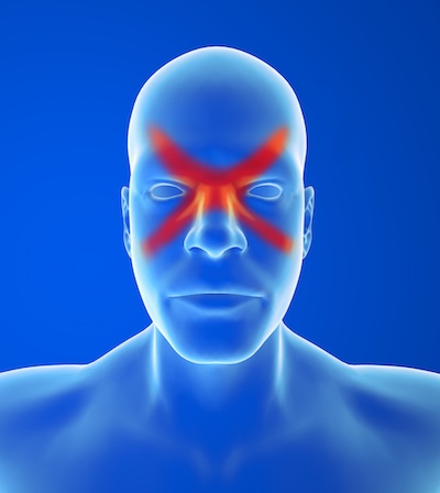 Sinus headache